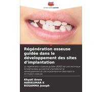 Régénération osseuse guidée dans le développement des sites d'implantation