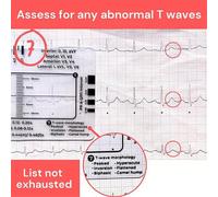 Regla de ECG de 7 pasos, herramienta de medición de plástico, para interpretación de ECG/EKG