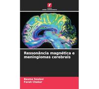Ressonância magnética e meningiomas cerebrais