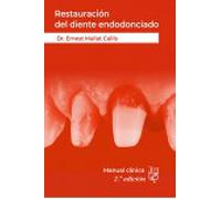Restauración del diente endodonciado: Manual clínico 2ª Edición