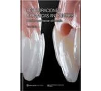 Restauraciones cerámicas anteriores. Detalles que marcan diferencia