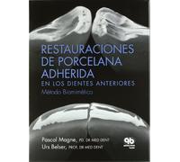 Restauraciones de Porcelana Adherida en los Dientes Anteriores: Un Enfoque Biomimético