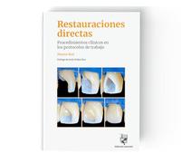 Restauraciones directas. Procedimientos clínicos en los protocolos de trabajo Marius Bud