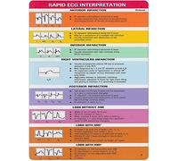 Resumen de conocimientos sobre ECG, letreros metálicos, guía de interpretación de ECG para atención primaria, carteles, guía de referencia para oficina, placa retro, decoración de pared para el hogar,