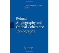 Retinal Angiography and Optical Coherence Tomography (2008-11-21)