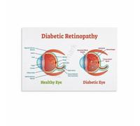 Retinopathy Knowledge Poster Canvas Wall-Art