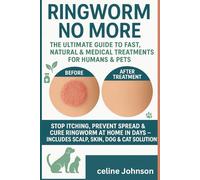 Ringworm No More: The Ultimate Guide to Fast, Natural & Medical Treatments for Humans & Pets": Stop Itching, Prevent Spread & Cure Ringworm at Home in ... - Includes Scalp, Skin, Dog & Cat Solutions"*