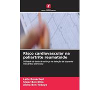 Risco cardiovascular na poliartrite reumatoide: Utilidade do teste de esforço na deteção da isquemia miocárdica silenciosa