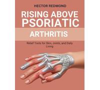 Rising Above Psoriatic Arthritis: Relief Tools for Skin, Joints, and Daily Living