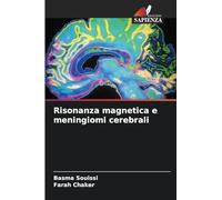 Risonanza magnetica e meningiomi cerebrali
