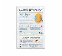 RNUMLIGH Human Eye Diagram Poster - Anatomical Chart Canvas Wall-Art for Doctor’s Office Student Gift(Unframed,16x24inch(40x60cm))