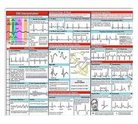 RNUMLIGH Vintage EKG Reading Metal Sign ECG Interpretation Guide Poster for Cardiologist Doctor Office Hospital Clinic Wall Decor Education Tin Art 8 X 12 inch