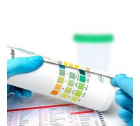 Roche Combur 3 Prueba Acero de la Tira de Orina Test 50 Pieza (11896814191)