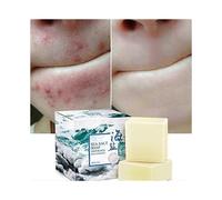 ROMANTIC BEAR Jabón de leche de cabra natural con sal marina, para eliminar puntos negros y cicatrices