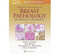 Rosen's Diagnosis of Breast Pathology by Needle Core Biopsy