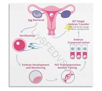 RQLVZHGK IVF Process Cycle Infographic Educational Poster Fertility Awareness Wall-Art Canvas Print for Home Bedroom Living Room Decor Framed,16x24inch(40x60cm)