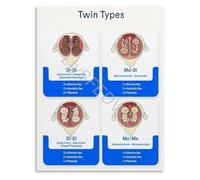 RQLVZHGK Placentation of Twins Chart Educational Poster Obstetric Department Wall-Art Canvas Print for Hospital Clinic Living Room Bedroom Decor Unframed,12x18inch(30x45cm)
