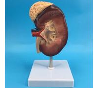 Ryanong Modelo anatómico de riñón humano agrandado 2 veces con estructura anatómica precisa y textura clara y etiquetado digital para observar las estructuras dentro del riñón humano.