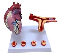 Ryanong Modelo de corazón humano, modelo de derivación de arteria coronaria del corazón, modelo de trombosis de bloqueo de vasos sanguíneos, modelos de enseñanza de ciencias para el aula y el estudio