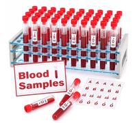 Sabary 48 paquetes de muestras de sangre de Halloween, tubos de ensayo de plástico con estante, calcomanías de tipo de sangre, tarjeta espeluznante, vampiro, zombi, decoración de fiesta de Halloween