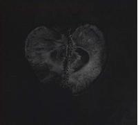 Sadon &Treha Sektori - Symphony Of Dying