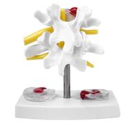 Sarini Disco Lumbar Anatómico, Modelo Científico De Columna Vertebral, Anatomía, Hernia De Disco, Modelo De Demostración, Columna Vertebral Humana, Modelo De Disco