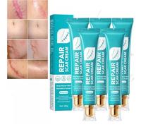 Scar Repair Cream,Repair Scar Cream,Advance Scar Gel,Scar Healing Cream,Scar Remover Cream,Scar Removal Cream for Men and Women Skin Repair (5 Pcs)