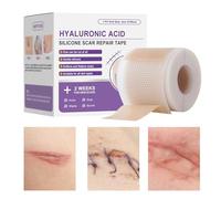 Scar Sheets, Silicone Scar Strips, 1.57x59.06in Skin Friendly, Breathable Design, Adhesive Recovery Sheet for Wounds, Face, Body, Burns, Gym Workouts, Traveling, Daily Wear, Outdoor Activities