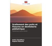 Scellement des puits et fissures en dentisterie pédiatrique: Scellants pour puits et fissures
