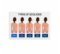 Scoliosis Spinal Curvature Poster Canvas Wall Decor