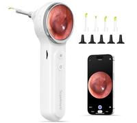 ScopeAround Otoscopio con luz, otoscopio Digital con Pantalla IPS de 1.85 Pulgadas, cámara de Herramienta de eliminación de Cera de oído HD de 720p, cámara de Video otoscopio con 6 Luces LED