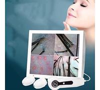 SEEANN 50X/200X Analizador de Cabello para diagnóstico de Piel, Pantalla LCD de 15 Pulgadas Máquina analizadora de Piel para diagnóstico de Piel Digital Operación Simple