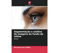 Segmentação e análise de imagens do fundo da retina: RFISAA
