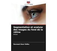 Segmentation et analyse des images du fond de la rétine: RFISAA