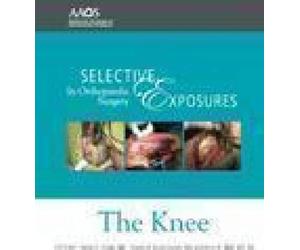 Selective Exposures in Orthopaedic Surgery: The Knee [Alemania]