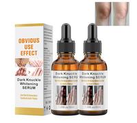 Sérum blanqueador de la piel, suero blanqueador de la piel, suero blanqueador de la piel oscura, reduce la edad de hiperpigmentación, elimina los nudillos oscuros de los dedos, para nudillos, codos