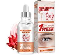Sérum para eliminar ojos Milia, suero facial contra manchas oscuras, para hombres y mujeres, reduce la flacidez de la piel, la hinchazón y las líneas finas, 30 ml (1 unidad)
