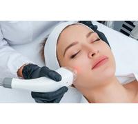 Sesión de lifting facial con radiofrecuencia Indiba