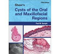 Shear's Cysts of the Oral and Maxillofacial Regions