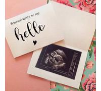 Shein 1 pieza Tarjeta de anuncio de embarazo - Bellamente diseñada con sobre a juego para compartir la emocionante noticia con la familia, el esposo, los ab