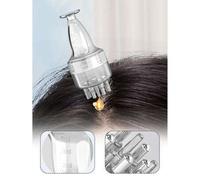 Shein Aplicador de aceite para el cabello de 4 ML - Con diseño de escala, aplicador de minoxidil, aplicador de masaje con bola para el cabello, botella apli