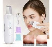 Shein Eliminador de Puntos Negros Eléctrico Ultrasónico, Dispositivo de Belleza para Succión de Puntos Negros, Limpiador de Poros de la Piel, Limpieza Indol