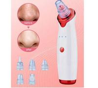 Shein Eliminador de puntos negros, extractor eléctrico de puntos negros por vacío para el rostro, acné, comedones, puntos blancos, kit con interfaz USB y 5