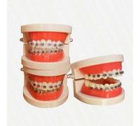 Shein Modelo de soporte metálico oral, modelo de visualización de comunicación con pacientes de clínica, modelo de soporte dental