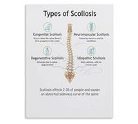 SHFTQXSLAT Functional Structural Scoliosis Poster Spinal Deformity Type Comparison Chart Physical Wall Print(Unframed,16x24inch(40x60cm))