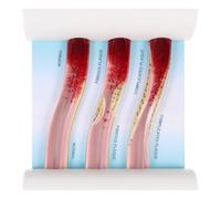 SHINEOFI Modelo Vascular Dinámico Anatómico de Plástico Modelo Didáctico de Vasos Sanguíneos Realista y Compacto para Enseñanza Médica y Formación Profesional Uso en Escuelas y