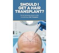 Should I Get a Hair Transplant?: The No-Nonsense Guide for Men Considering a Hair Transplant