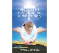 Showing My Scars for the Glory of God