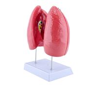 Shuade Modelo educativo de anatomía pulmonar humana anatómica humana con componentes desmontables, herramienta de enseñanza de anatomía normal