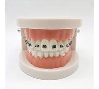 Simulación oral dientes - Dental ortodoncia modelo demostración - dientes dentales estudiar la enseñanza Model - Modelo tratamiento con soporte metálico, arcos alambre Explicando Modelo con tirantes,A